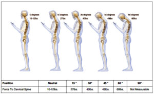 cervical-spine-stress